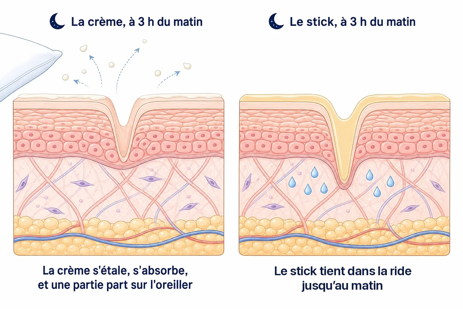 Coupe de la peau à 3 h du matin : à gauche, il ne reste presque plus de crème dans les ridules ; à droite, le baume du stick y est encore