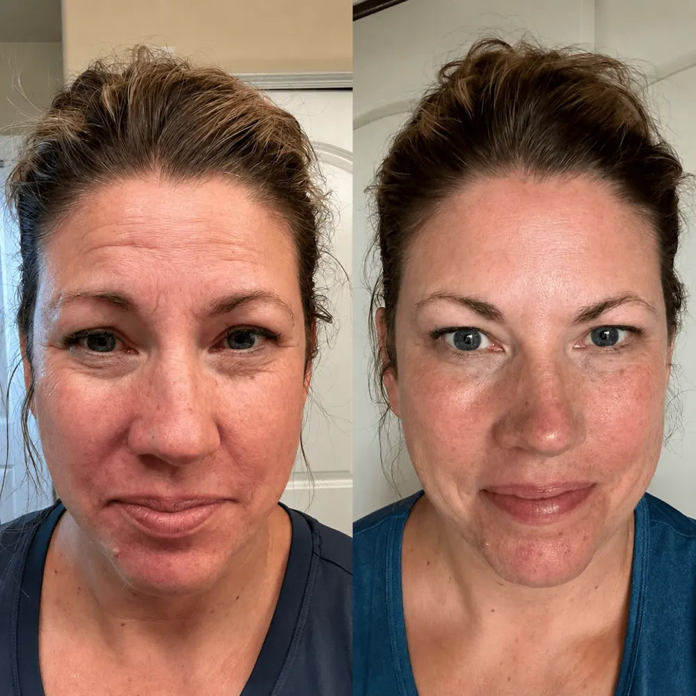 Le même visage avant et après, photos d'une utilisatrice