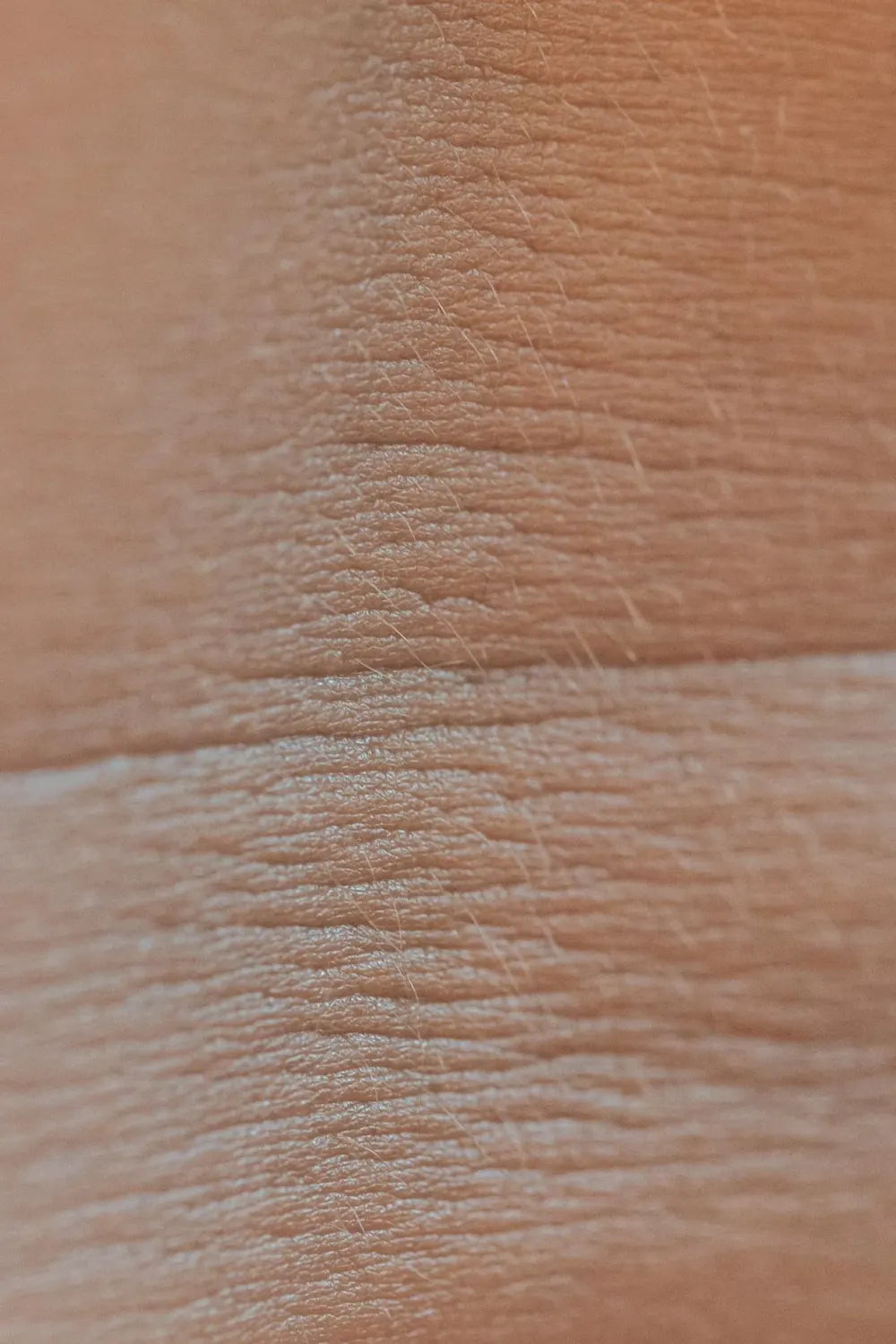 Le contour de l'œil est sec en permanence