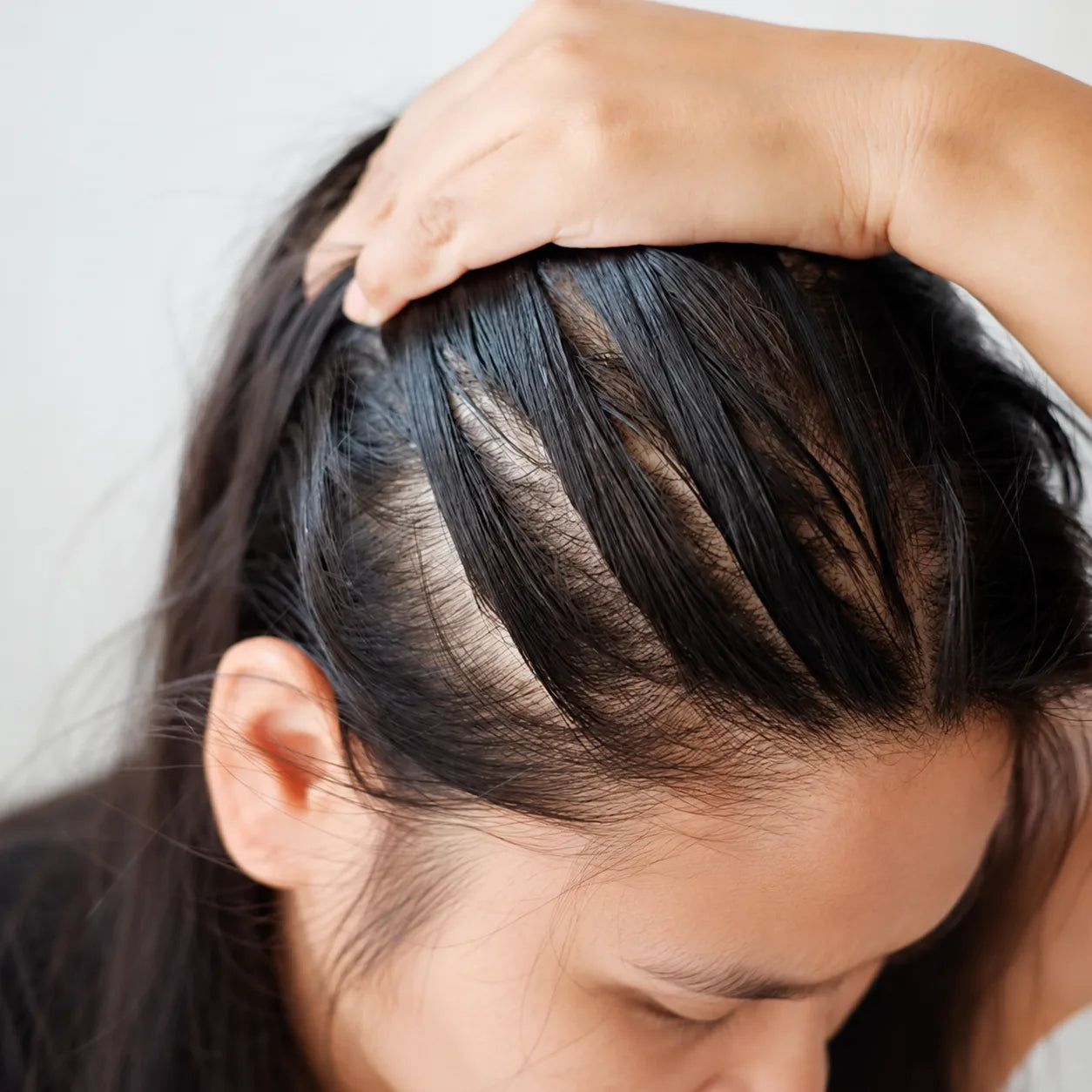Gros plan d'une tempe : cheveux qui s'affinent et duvet clairsemé