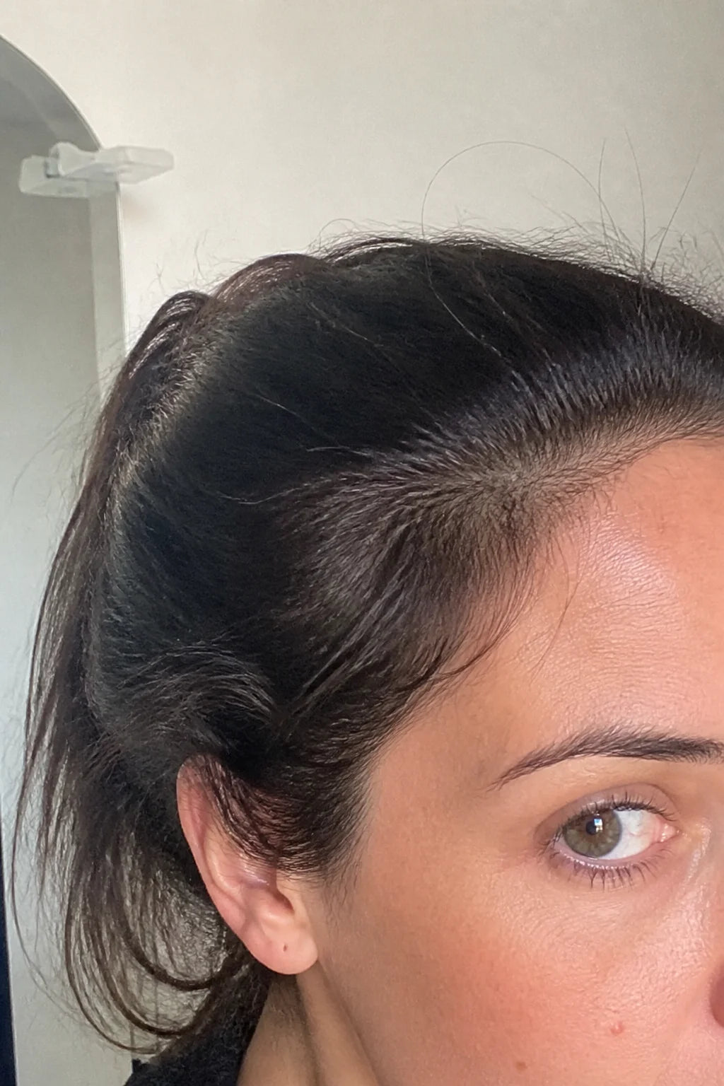 Photo cliente Audrey · contour du visage