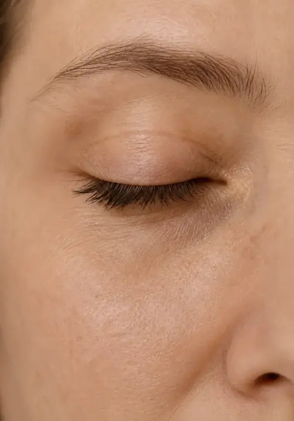 Peau fatiguée